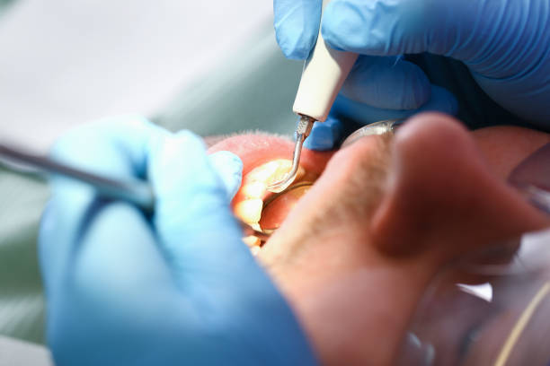 Best Knocked-Out Tooth Emergency  in North Amityville, NY
